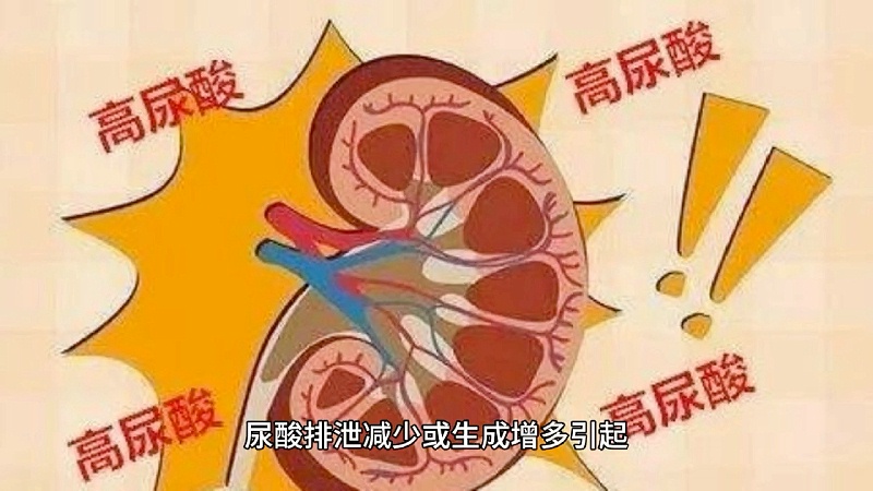 高尿酸